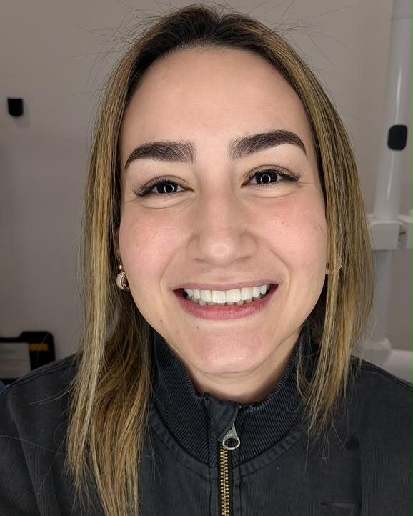 SmileZone patient smile result