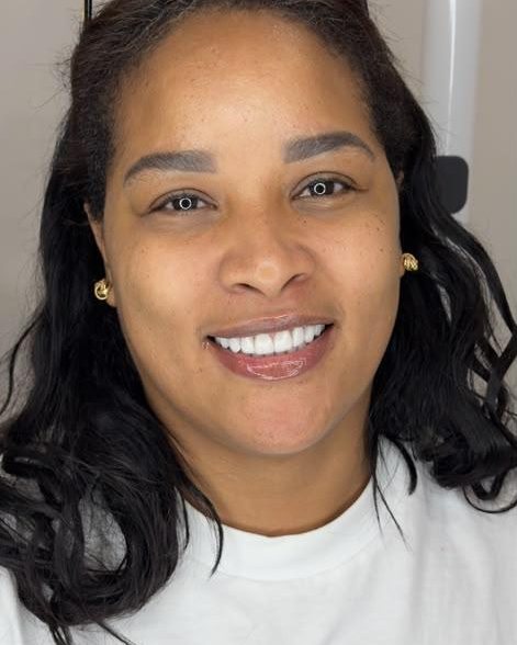 SmileZone patient smile result