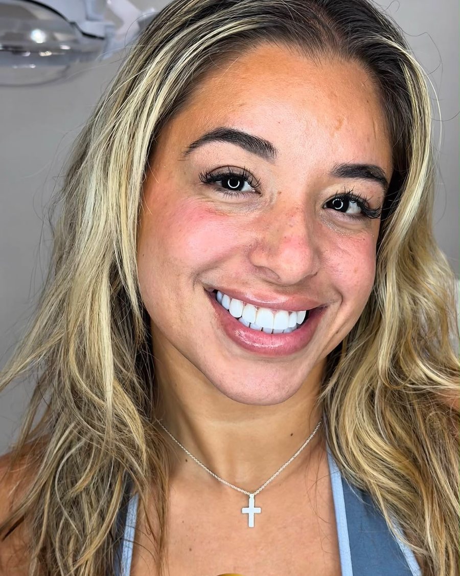 SmileZone Dental patient smile